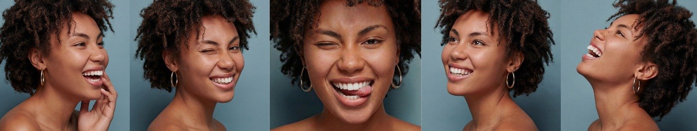 Patient showing beautiful E.max smile design transformation